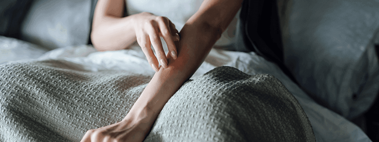 Kelebek Hastalığı (Lupus) Nedir ve Bilmeniz Gereken Her Şey